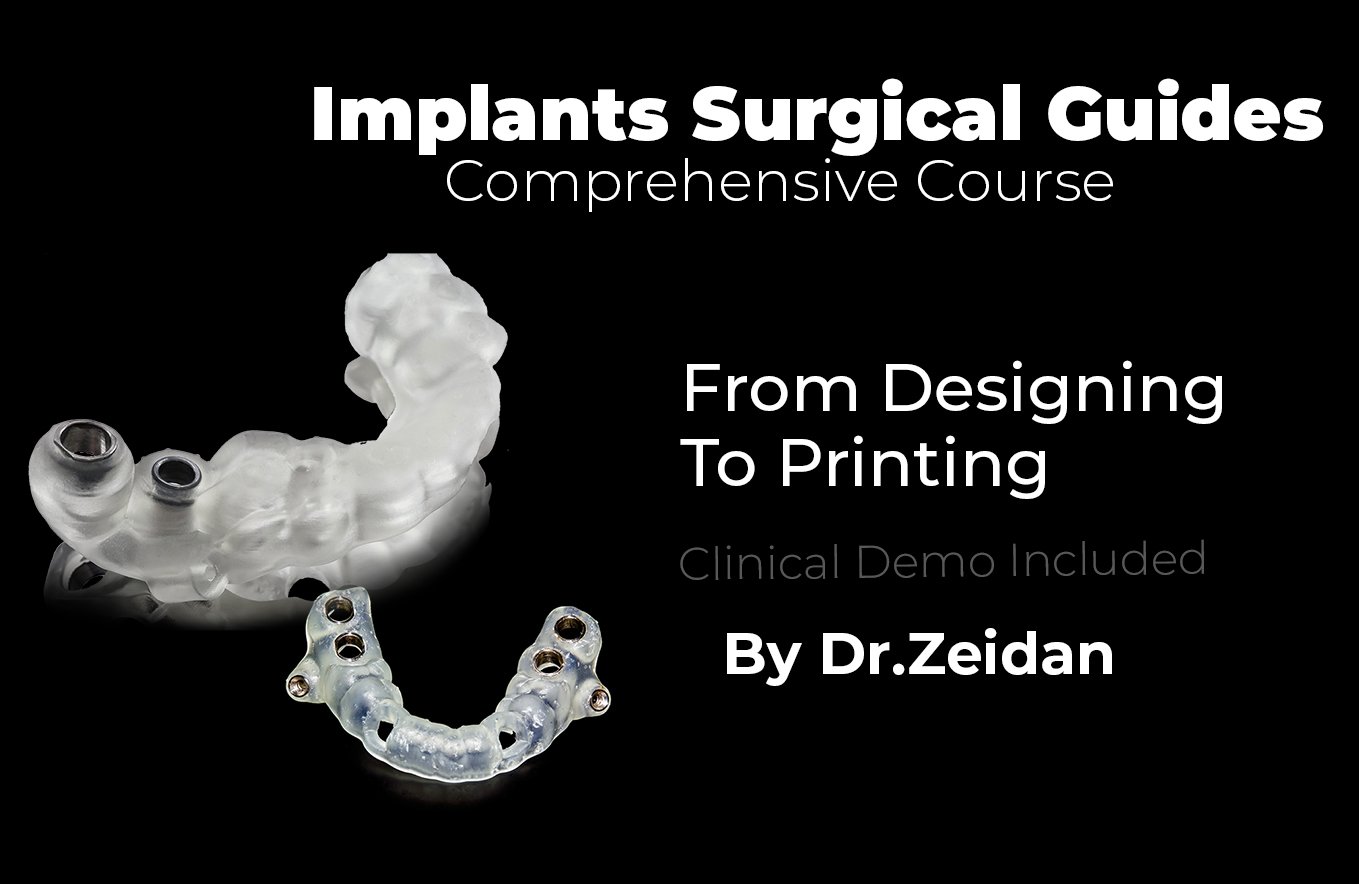 Implant Surgical Guide From Basic To Advanced